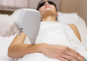 Laser Hair Removal Glasgow | Everything You Need to Know Laser Hair Removal Glasgow | Everything You Need to Know