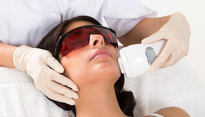 laser hair removal glasgow