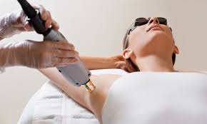 laser hair removal glasgow